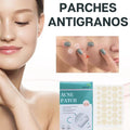 Parche anti acné winner